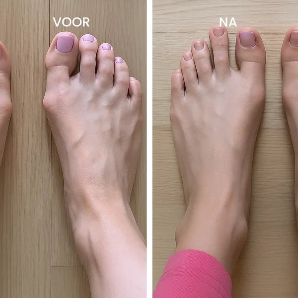 Hallux Valgus Korrektor