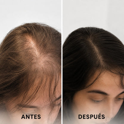 Aceite Crecimiento Capilar
