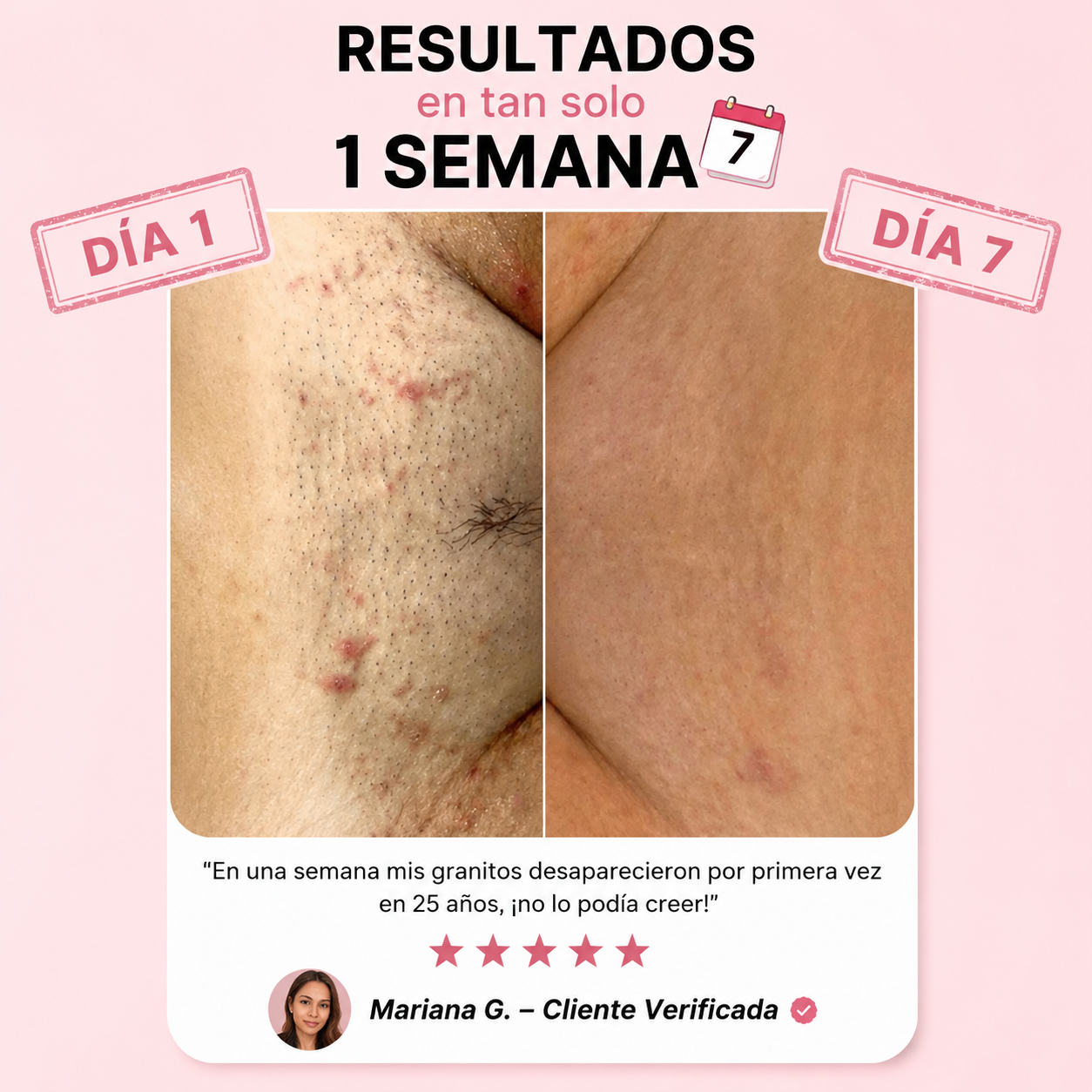 Maquinilla de Afeitar Anti-Irritación Novarelasos
