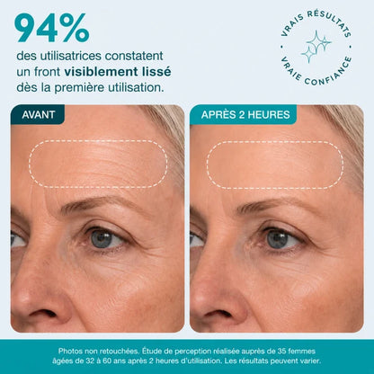Patch Skinjection aux peptides — Visage & Contour des yeux