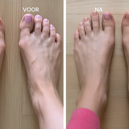 Hallux Valgus Korrektor